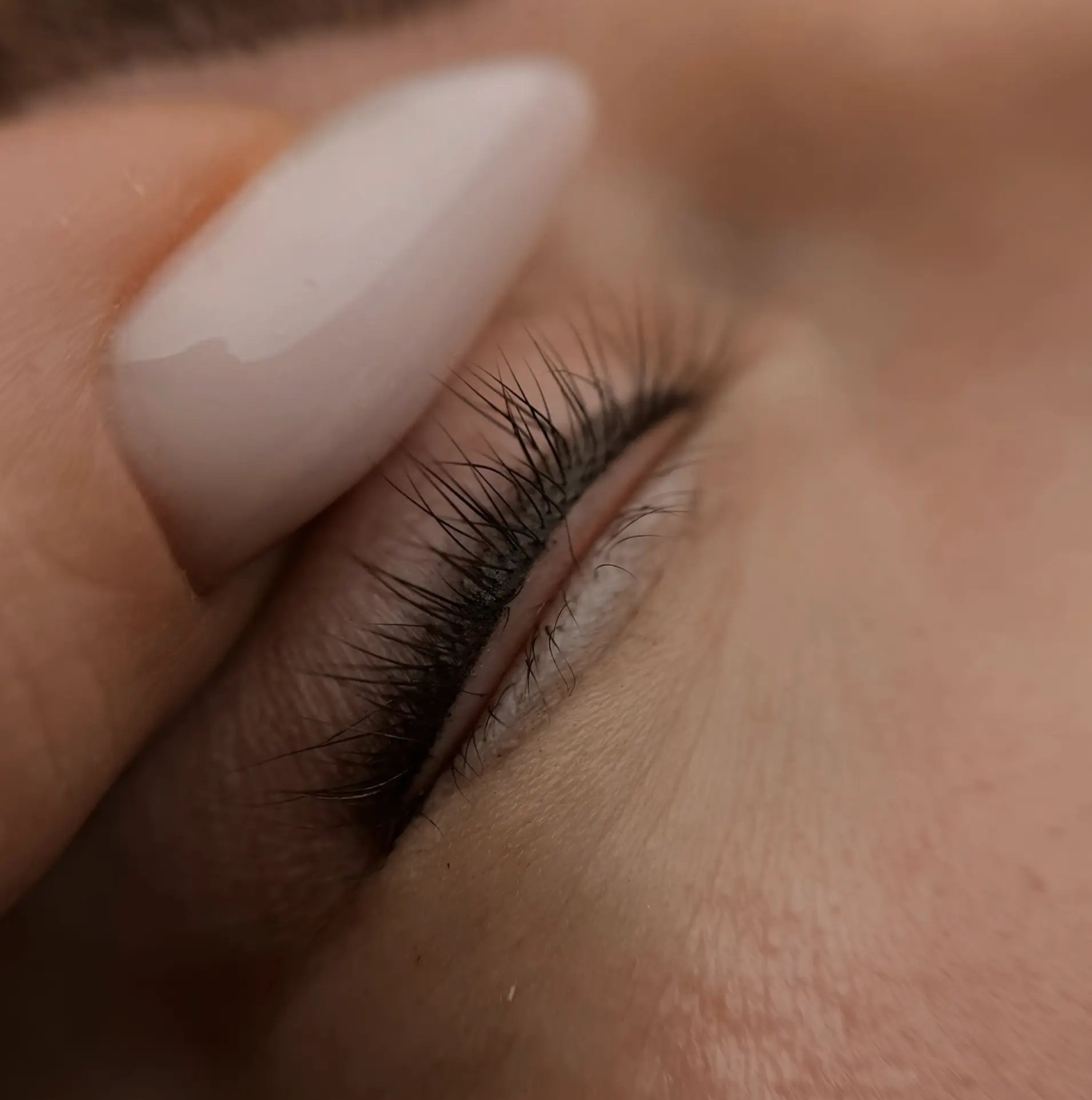 Is eyeliner tattoo removal painful?