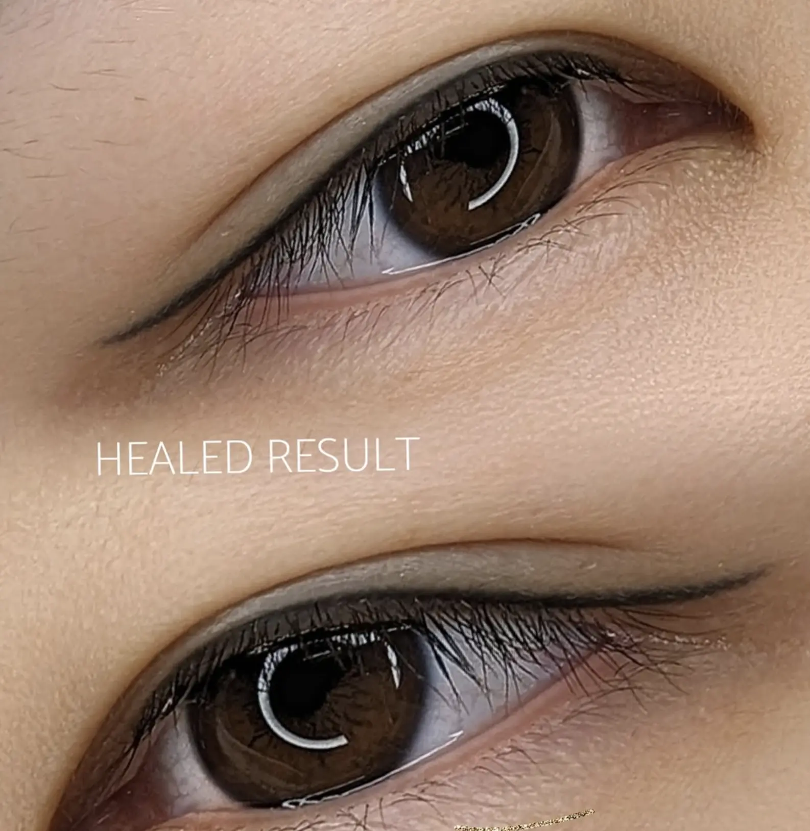 cosmetic eye tattoo